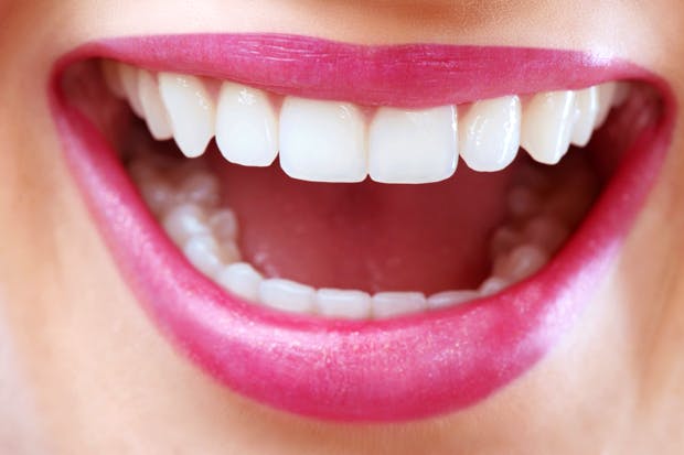 Quick Teeth Whitening Fix That You Can Do in 5 Minutes or Less